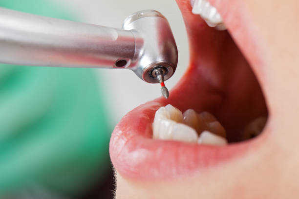 Reliable CA Emergency Dental Service Solutions